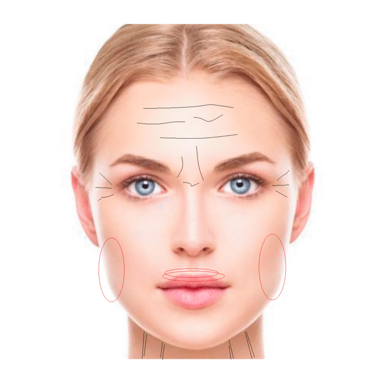 Youthful and Rejuvenated Skin with Botulinum Toxin